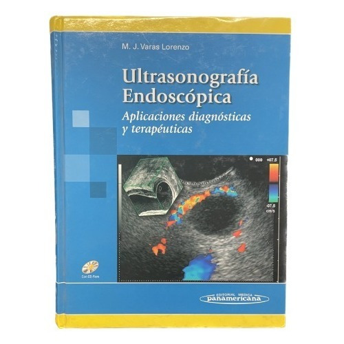 Ultrasonografía Endoscópica - M. J Varas Lozano 