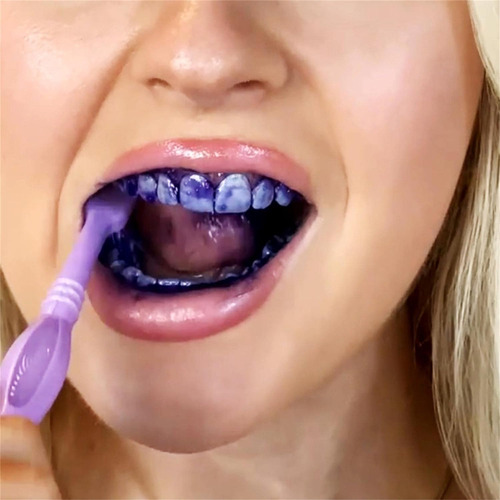 Remova O Tártaro Amarelo E O Mau Hálito 3 Dentífrico