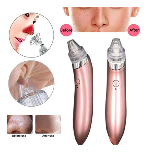 Kit Com Extrator Elétrico + Máscaras Desidratadas + Brinde