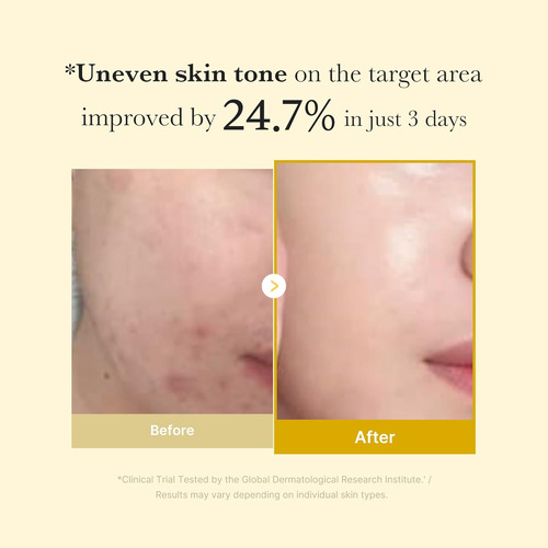 Mascarilla Exfoliante Nocturna Con Ácido Kójico Y Cúrcuma Me