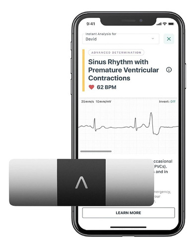 Ecg Eletrocardiograma Alivecor Kardia Mobile 6l Ekg Portátil