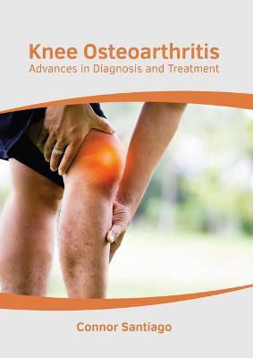 Libro Knee Osteoarthritis: Advances In Diagnosis And Trea...