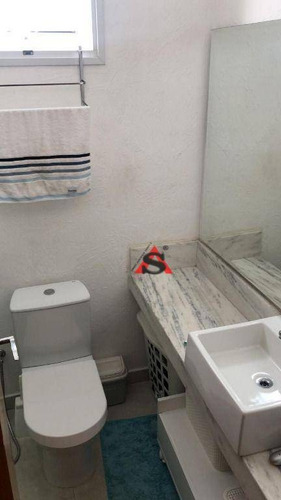 Imagem 26 de 30 de Sobrado Com 3 Dormitórios À Venda, 120 M² Por R$ 1.200.000,00 - Chácara Inglesa - São Paulo/sp - So5365