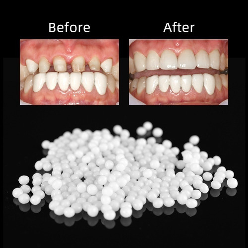 1 Par Temporal Sonrisa Confort Ajuste Cosmético Dientes Dent