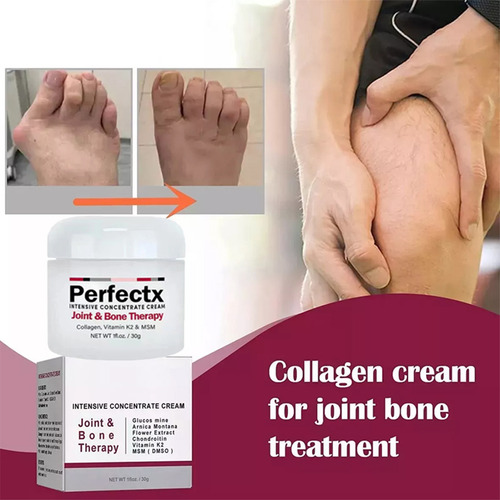 Creme Ósseo Para Articulações De Terapia Intensiva Para