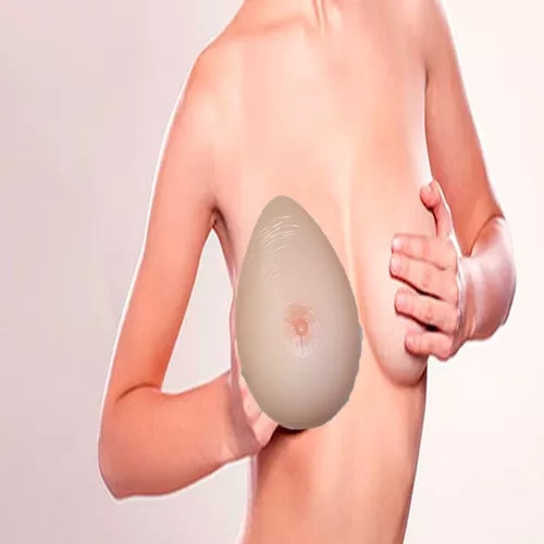 Implante De Seno Anatomicas , Copas C Y D, Tallas Extras en venta