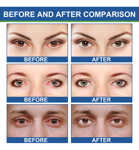 Crema Reafirmante Eve Cream J Eye Cream. Eye Repair Nourishi
