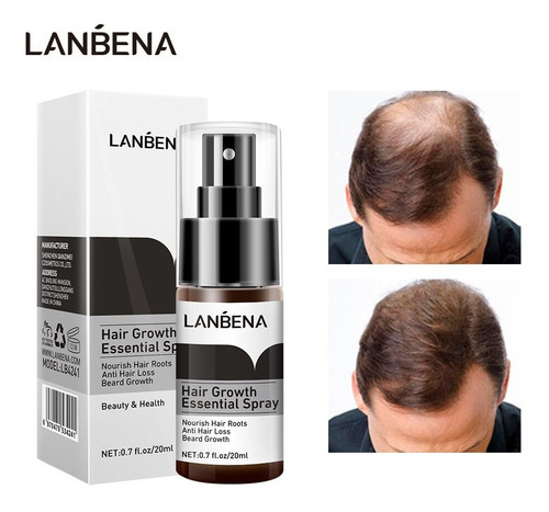 Spray Lanbena Crecimiento De Cabello Comprobado