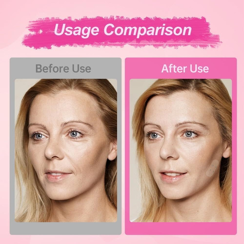 Fita De Levantamento Facial Invisível, 2024 Nova Fita