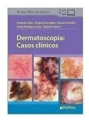 Dermatoscopia: Casos Clínicos - Cabo, Horacio (papel+digita