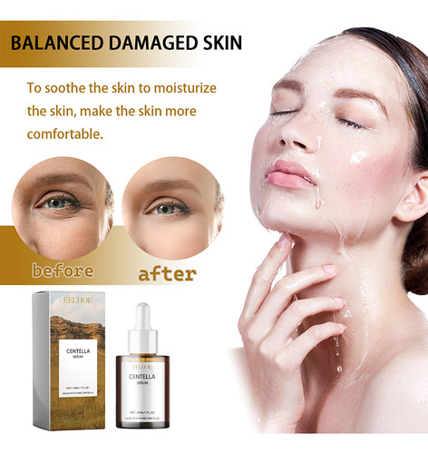O Sérum Facial Coreano Centella Asiatica Nutre A Pele Seca