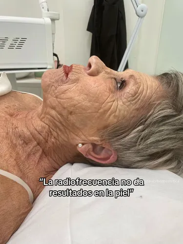 Radiofrecuencia