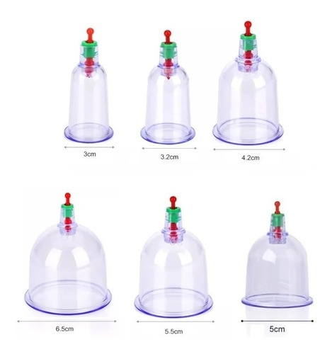 Ventosas Chinas Kit Vacumterapia Chupones 6 Pcs