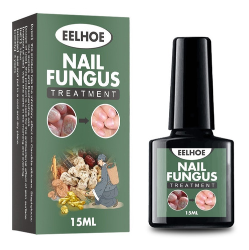 Alivia Uñas Enterradas Elimina Onicomicosis Nail Fungus