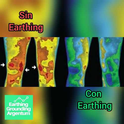 Kit Earthing Grounding Full Por Pulsera + Jabalina No Mats