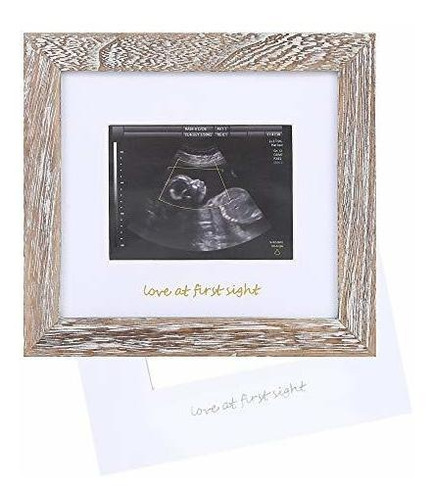 Iheipye Baby Love At First Sight Sonogram Marco De Recuerdo 