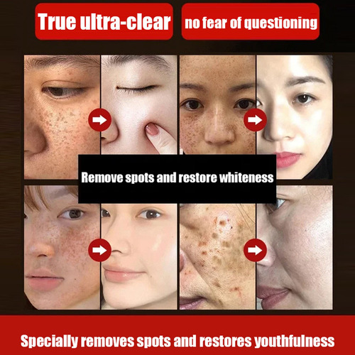 Máscara Facial Para Eliminar Manchas, Máscara Facial Desgarr