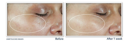 Crema Hidratante Roc Multi Correxion Revive + Glow Vitamina