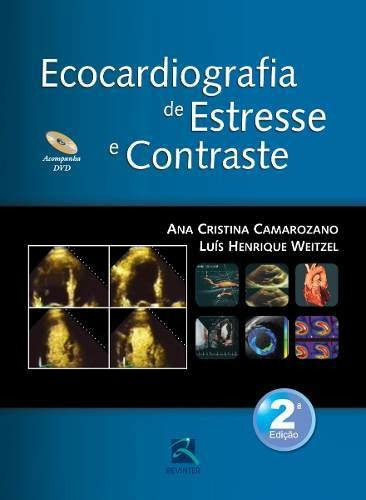 Ecocardiografia De Estresse E Contraste