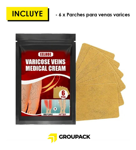 6 Parches Para Eliminar Las Venas Varicosas En Las Piernas