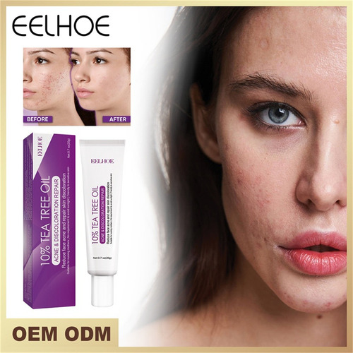 Crema X Azelaic, 10% Azelaic Booster Healing, Para Rostro Y