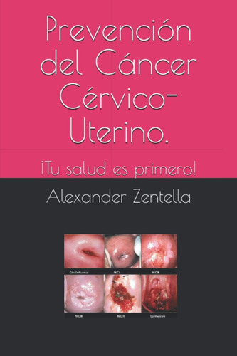 Libro: Prevención Del Cáncer Cérvico-uterino.: ¡tu Salud Es