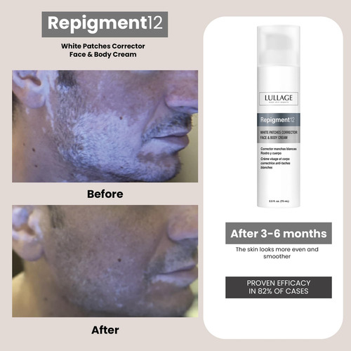 Repogmento De Lullage12 Patches Blancos Crema Corrector Para