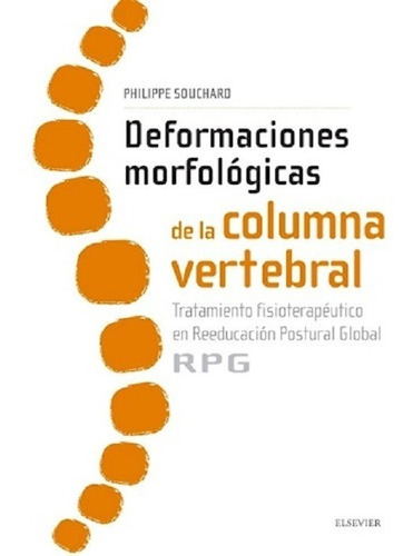 Deformaciones Morfológicas De La Columna Vertebral :tratami