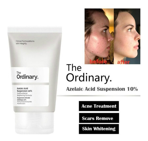 The Ordinary. Azelaic Acid Suspension 10% (30ml) Acne 