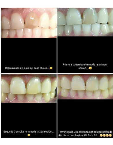 Imagen 9 de 10 de Consultorio Odontológico/ Dentista/ Prótesis Dentales