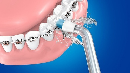 Irrigador Dental Limpieza Bucal Mayor Potencia H2ofloss