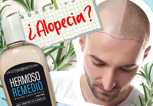 Imagen 3 de 10 de Kit Barba Y Cabello Hermoso Anticaída Crece Anticaspa Hombre