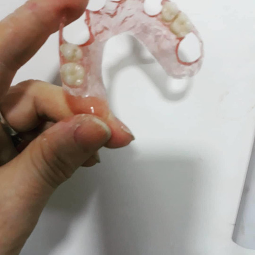 Cursos De Mecánica Dental (protesista Dental)
