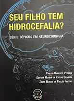 Comprar SEU FILHO TEM HIDROCEFALIA?, de PEREIRA, CARLOS UMBERTO u002F OLIVEIRA, DEBORA MOURA DA PAIXAO u002F FREITAS, ZAIRA MOURA DE PAIXAO. Editorial Sparta, tapa mole en português