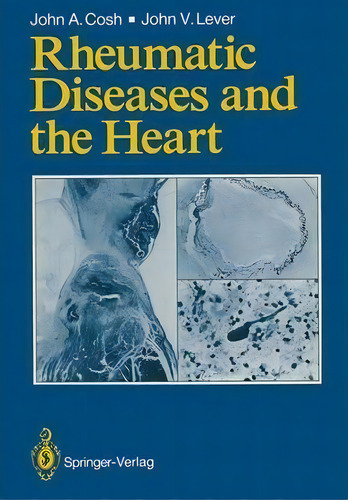 Rheumatic Diseases And The Heart, De John A. Cosh. Editorial Springer London Ltd, Tapa Blanda En Inglés