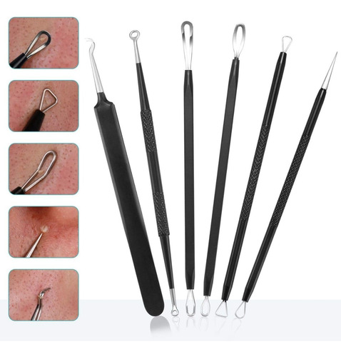 6 Kit Removedor De Espinillas, Extractor De Acné, Removedor