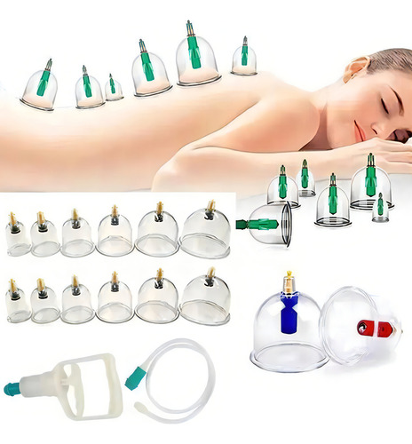 Kit 12 Ventosas De Vidrio Adelgazamiento Terapeuticas