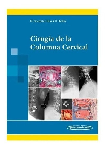 Cirugía De La Columna Cervical Gonzalez Nuevo!