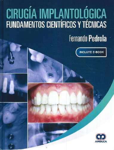 Libro Cirugía Implantológica De Fernando  Pedrola