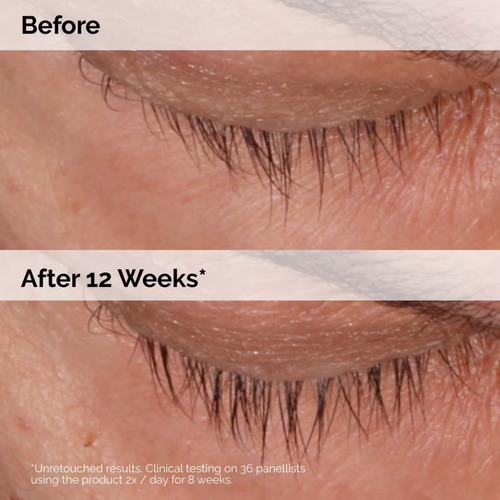 Multi-peptide Lash And Brow Serum - Suero Pestañas Y Cejas