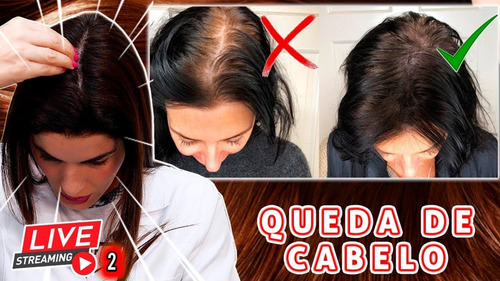 2 Kits Crina De Cavalo Capil Horse Kit De Crescimento