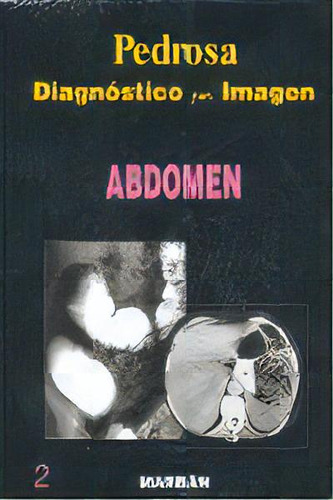 Diagnostico Por Imagen Vol. Ii Abdomen, De Pedrosa. Editorial Marban En Español