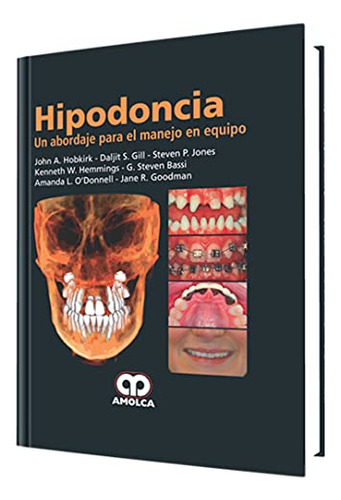 Libro Hipodoncia De John A Hobkirk Daljit S Gill Steven P Jo