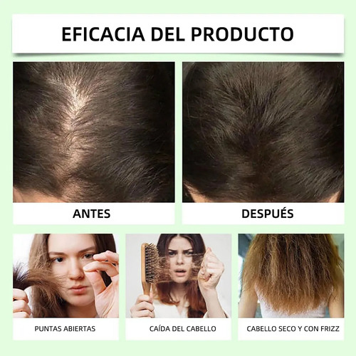 Shampoo Anti-queda De Cabelo Lc Remimpi 4 Unidades