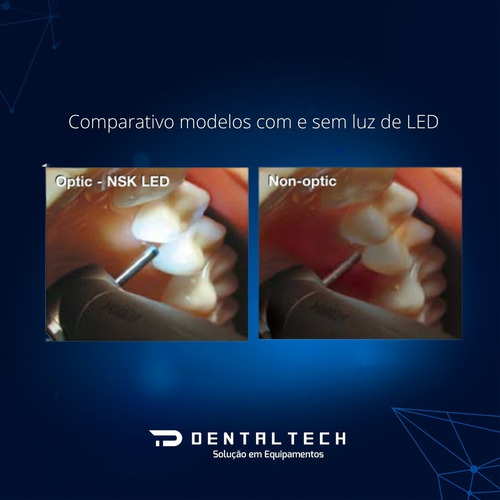 Imagem 2 de 6 de Alta Rotação Dynaled M600LG B2 Nsk