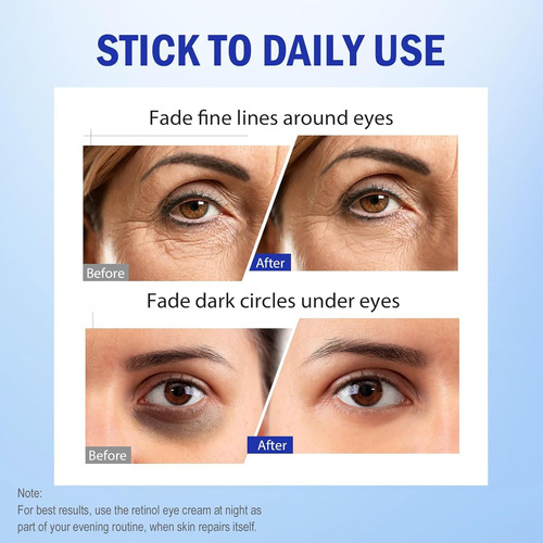 Crema De Ojos Lenaale Con Retinol Y Aha 30%, Antiarrugas Todo Tipo De Piel Noche