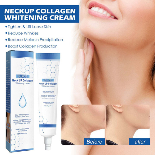 Crema Blanqueadora F Para Blanquear Las Líneas Del Cuello Y
