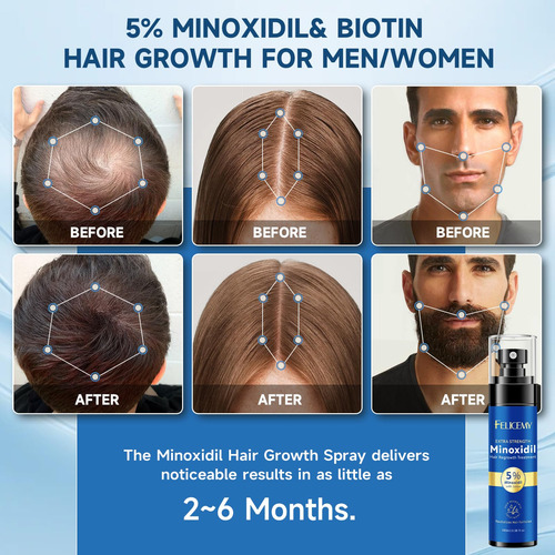 Minoxidil Spray Felicemy 5% Para El Crecimiento Del Cabello