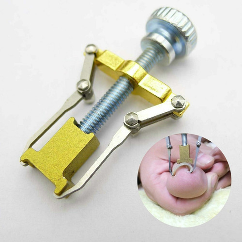 Kit Corrección Uñas Encarnadas Pie Herramienta Pedicura Lima