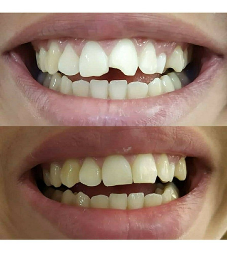 Imagen 5 de 10 de Consultorio Odontológico/ Dentista/ Prótesis Dentales